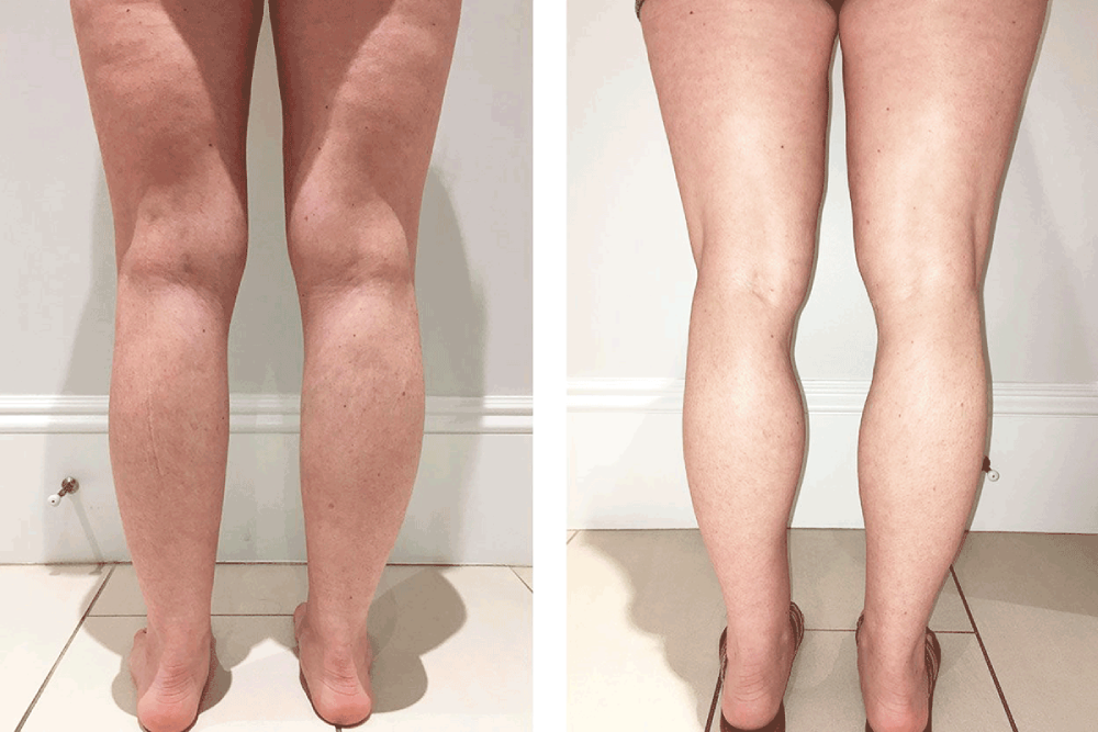 [🧘🇻🇳] Nguyễn Hiếu Yoga 🧘Top1Yoga🕉️ – Những lưu ý để giảm cân lành mạnh, giữ được vóc dáng ngày Tết



Nguyễn H …