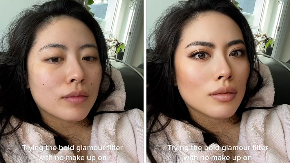 TikTok filter và xu hướng phẫu thuật thẩm mỹ