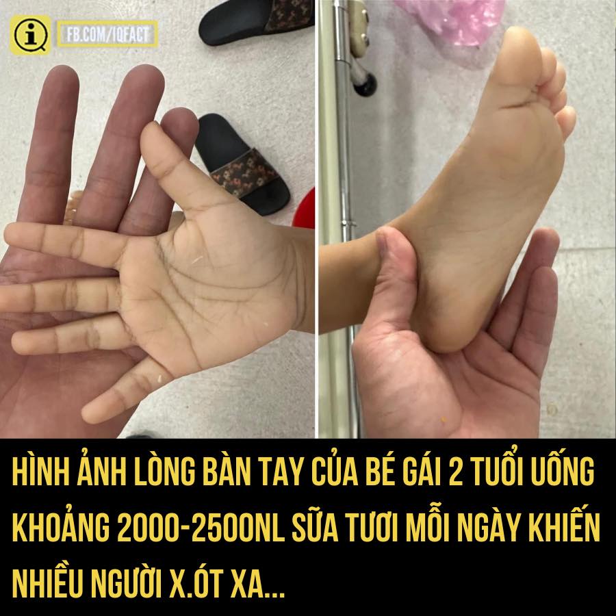 [🆕🇻🇳] Hi, embe –  Cửa hàng quần áo sơ sinh & trẻ em – Say “Hi” & Be a happy child with us :) 🧑‍🧒❤️️👶⭐️ Nhìn lòng bàn tay của bé gái 2 tuổi uống khoảng 2000-2500 ml sữa tươi mỗi ngày khiến nhiều người x.ót xaTheo bác sĩ Nguyễn Thanh Sang (Bệnh viện Nhi Đồn , shares-0✔️ , likes-11❤️️ , date-2024-05-07 01:30:07🇻🇳🇻🇳🇻🇳📰🆕