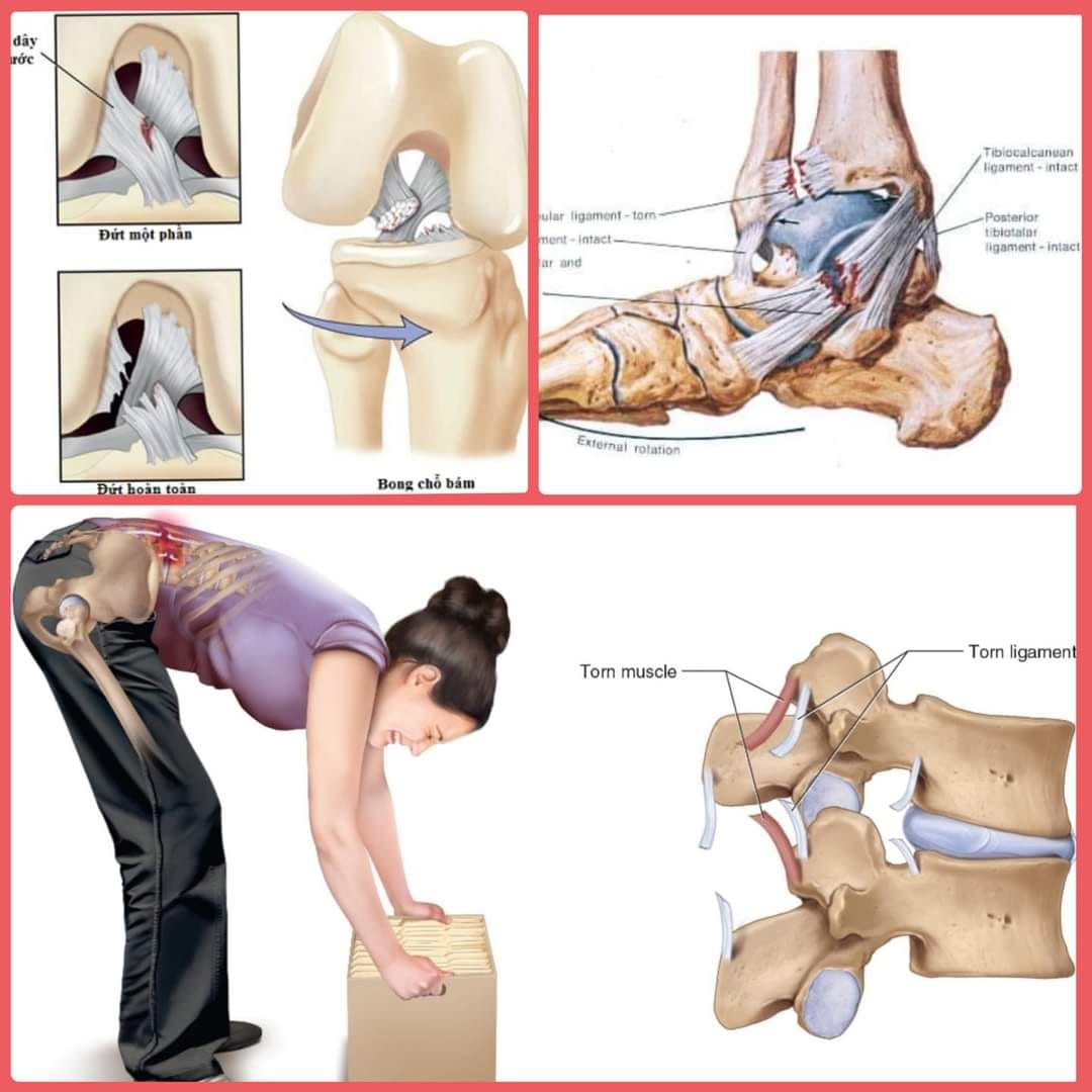 [🆕🇻🇳] Ban Mai Yoga Academy 🧘 Top1Yoga 🧘 DÂY CHẰNG  – NỖI ĐAU & LỜI CẢNH TỈNH!!!

Ngày xửa ngày xưa, trong một gia tộc nọ có 2 anh em, được đặt tên là CƠ & DÂY CHẰNG. Hai anh em đều rất khỏe và số , shares-0✔️ , likes-9❤️️ , date-2021-05-14 14:34:29🇻🇳🇻🇳🇻🇳📰🆕