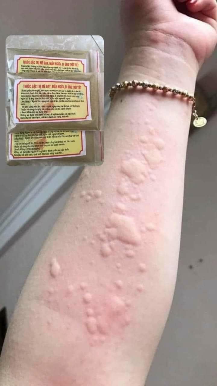 [🆕🇻🇳] Hong Ha Yoga – Ở đây có đam mê yoga � 🧘 Top1Yoga 🧘 Cuối tuần mời bạn ngắm học trò cưng – siêu cong của team cong chúng mình nhé, nhìn từng này tư thế, ko có tấm nào thẳng là biết  , shares-0✔️ , likes-0❤️️ , date-2024-11-13 13:47:01🇻🇳🇻🇳🇻🇳📰🆕