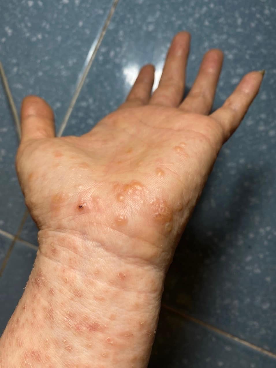 [🆕🇻🇳] AVAKids – Siêu thị cho mẹ và bé 🧑‍🧒❤️️👶⭐️ Giá sốc cuối tuần, giảm đến 50%++

 Tã, Sữa – sản phẩm thiết yếu cho bé yêu giảm sốc!
 Trả chậm 0% lãi suất trong 3 tháng – mua sắm thả ga, không lo tài ch , shares-0✔️ , likes-0❤️️ , date-2025-01-10 18:00:09🇻🇳🇻🇳🇻🇳📰🆕